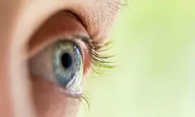 Отслойка сетчатки глаза