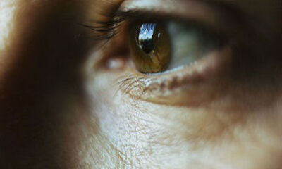 Отслойка сосудистой оболочки глаза (ОСО) после хирургических операций — катаракты и глаукомы