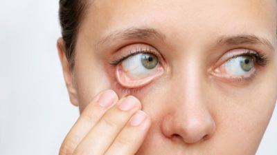 Болезни сетчатки глаза — какие бывают, в чем отличия и кто в группе риска?