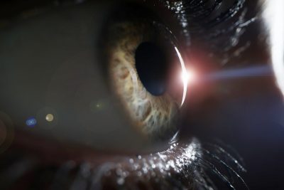 Отслоение сетчатки глаза: причины, симптомы, лечение