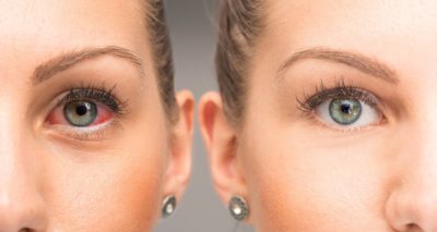 Сетчатка глаза: лечение, диагностика и профилактика патологий и заболеваний