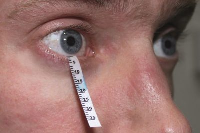 Синдром сухого глаза (ССГ) — причины, симптомы и лечение